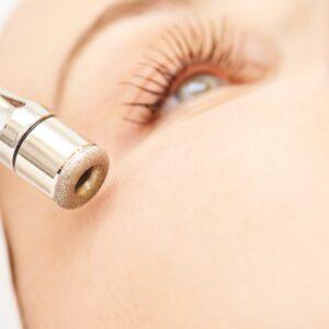 Microdermabrasion
